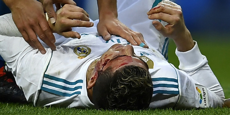 Ronaldo Bersimbah Darah Zidane Sebut Tak Ada yang Serius